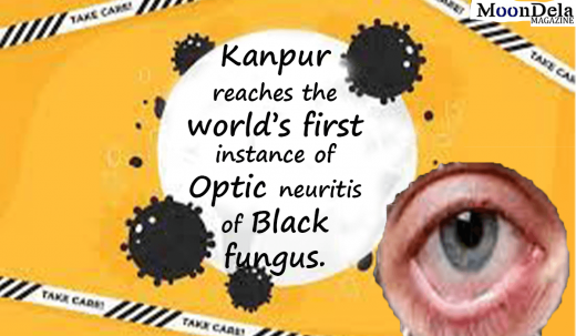 Kanpur reaches the world’s first instance of Optic neuritis of Black fungus